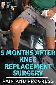 Pin On Knee