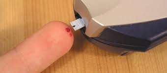 We did not find results for: Starting Empagliflozin In People On Insulin And With Good Glycaemic Control New Zealand Doctor