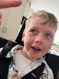 Aloe Propolis creme alla dar i veckan. Hör av dig om du vill testa.