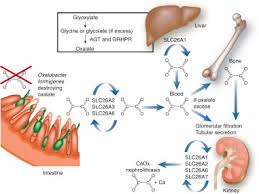 A New Era In The Treatment Of Calcium Oxalate Stones Sciencedirect