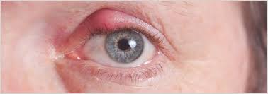 Image result for Blepharis bainesii