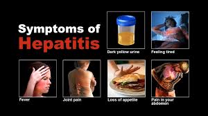 Image result for hepatitis symptoms