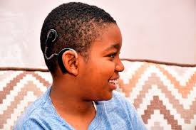 Baby Amari was born deaf. Now he hears and speaks