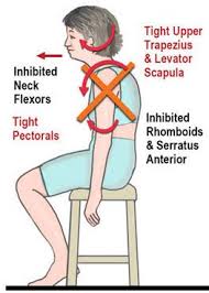 Fix Upper Cross Posture Issues With Massage Therapy In Des Moines Ia Massage Therapy Therapy Shoulder Muscles