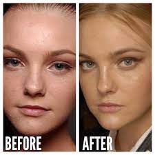 When under the care of your dermatologist or doctor, isotretinoin or accutane is mostly considered safe and one of the most effective treatments for severe acne. Should I Go On Accutane