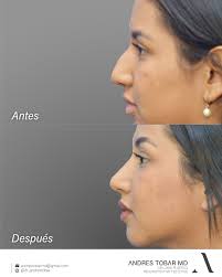 Andres Tobar Padilla MD (@dr_andrestobar) • Instagram photos and videos