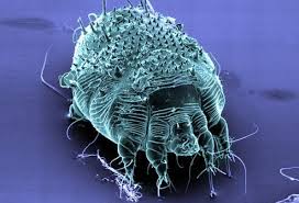 Scabies Treatment Causes Symptoms Pictures Contagious Mistaken For