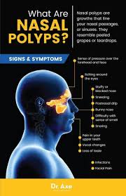 Yes, you can, there are thousands of people who had polyp growths in their nose tried natural methods to get here is the best strategy to manage nasal polyps safely? Do You Have Strange Bumps Inside Your Nose If So You May Have Nasal Polyps Or Nasal Polyposis Nasal Polyps Are Pretty Common Heal Cavities Sinusitis Polyp