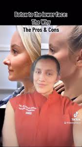 The more you know: , Botox to the lower face can sharpen the jawline AND  increase the volume to the midface in small amounts!, This can be a great  option for those who aren’t ready for filler 💉, ...