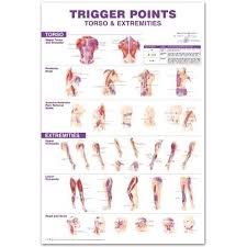 Trigger Points Giant Chart
