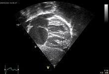 Nella maggior parte dei casi di miocardite virale la malattia si risolve spontaneamente senza alcuna complicazione; Ecocardiografia A Domicilio Brindisi Dott Maurizio De Giorgi