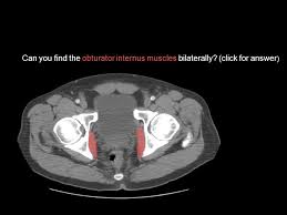 Labeled scrollable mri of the pelvis covering anatomy with a level of detail appropriate for medical students. Axial Pelvic Ct These Are Axial Ct Images Starting Superior And Working Inferior This Powerpoint Consists Of Two Sets Of Images One Labeled With Questions Ppt Video Online Download