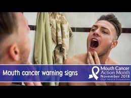 According to the national institute of dental craniofacial research (nidcr), over half of those in the u.s. The Warning Signs Of Mouth Cancer Youtube