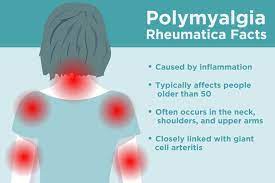 Receive the most money for your jewelry, gold, diamond, watches, sterling, and coins. What Is Polymyalgia Rheumatica These Are The Signs You Could Have It Creakyjoints Australia