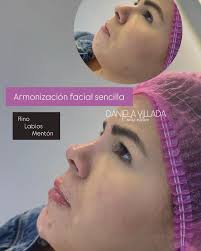 Reel by 𝐂𝐄𝐍𝐓𝐑𝐎 𝐄𝐒𝐓𝐄𝐓𝐈𝐂𝐎 𝐃𝐀𝐍𝐈𝐄𝐋𝐀 𝐕𝐈𝐋𝐋𝐀𝐃𝐀  (@centroestetico_danielavillada) · August 27, 2025