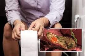 Early warning signs of liver cancer. Fatty Liver Disease Non Alcoholic Symptoms Include Dull Pain Express Co Uk