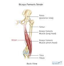 The present study offers findings that foam rolling to quadriceps alone is effective in decreasing the activation of biceps femoris muscle. Biceps Femoris Strain Rehab My Patient