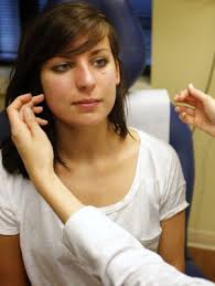 Doctors tailor teen acne treatments