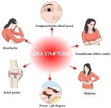 Wash off repellent at the end of treatment for zika virus is directed at relieving the symptoms of infection. Frontiers Zika Virus Infection During Pregnancy And Congenital Abnormalities Microbiology