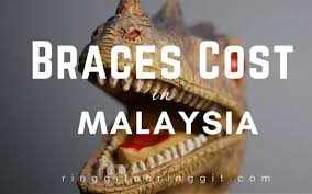 Postingan lebih baru postingan lama. 3 Things To Know About The Cost Of Braces In Malaysia Free Malaysia Today Fmt