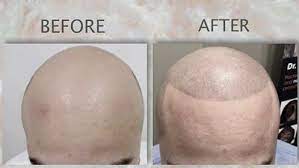 These head shaving tips are for all you balding men! The Benefits Of Shaving Your Head