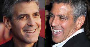 20 Celebrities Who Fixed Their Smiles Mom Com