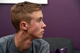 Teenager scarred for life in bottle attack slams justice system as slasher  walks free