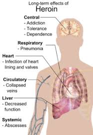 Heroin Wikipedia
