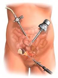 Pin On Surgical Funnies