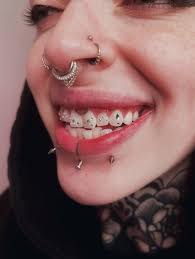 had all the fun blinging out the lovely @__xandra 's smile 🦷✨ i honestly  lost track of how many gems we did in total, but that's what happens when  you give me
