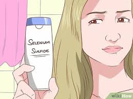 Ada ubat x?sy xberkesemoatan untuk pergi ke temerloh aslkm dokter nak tanye ini tempat klinik kecantikan deket mne ade tak krem siang mlm biar wajah cerah ini saya timbul jeragat di wajah. 4 Cara Untuk Menyembuhkan Eksem Kulit Kepala Wikihow