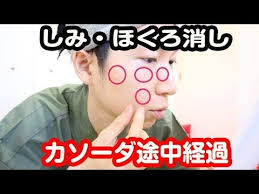 消しゴムのようにシミやホクロが取れるカソーダを試してみた youtube アンチエイジング スキンケアのアドバイス 顔 シミ 消す