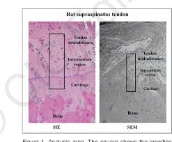 I m getting confused when i see bubbles like thing in a koh test on a epithelial cell under microscope that it is spore or just bubble. Pdf Novel Characteristics Of Normal Supraspinatus Insertion In Rats An Ultrastructural Analysis Using Three Dimensional Reconstruction Using Focused Ion Beam Scanning Electron Microscope Tomography Semantic Scholar