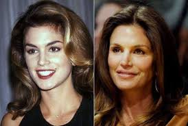 Cindy Crawford Plastic Surgery Before And After Photos Celebrity Plastic Surgery Plastic Surgery Photos Plastic Surgery