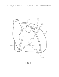 Bodytomy provides a labeled iliac artery diagram to help you understand the anatomy and function of the common iliac. Automated Identification Of Culprit Coronary Artery Diagram Schematic And Image 02