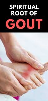 Gout Gouty Arthritis Spiritual Meaning Causes And Healing Gout Gout Remedies Gout Toe