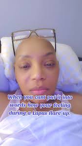 Lupus Awareness month #lupuswarrior #lupusflare #lupusstrong #everyoneシ゚  #everyoneactive #JesusHeals @highlight
