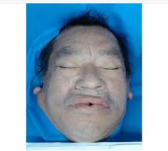 I found additional info