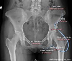 Pin On Runners Hip Pain