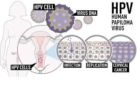 A common question that many people ask is 'can cancer go away on its own?'. Childhood Hpv Vaccine Lowers Precursor To Cervical Cancer Greater Than Expected Cbc News