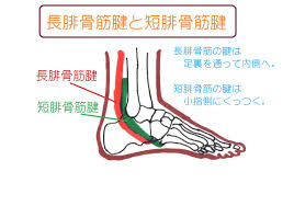 外くるぶし】の下や後ろの痛み。「腓骨筋腱炎」は足の着き方が原因！