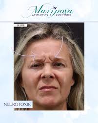 Mariposa Aesthetics & Laser Center