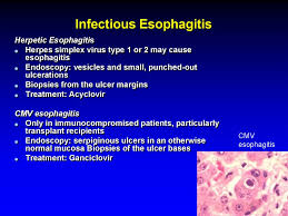 It connects the pharynx to the stomach; Esophagus Esophageal Structure Online Presentation