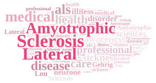 Risultati immagini per Sla