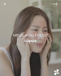 Selain pengunaan obat, pasien lupus harus dijelaskeun mengenai lupus dan  organ yang terlibat pada pasien, pola hidup sehat seperti aktivitas fisik  dan olahraga dan nutrisi, edukasi terkait kesehatan perempuan, hal-hal yang  harus