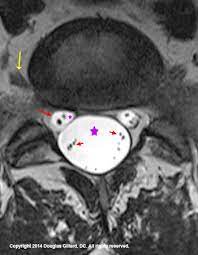 Pin On Mri
