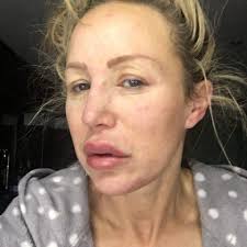 Reaction And Resilience