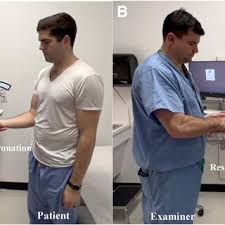 Image result for Yergason Test