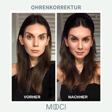 Ohren Anlegen Kosten Risiken Behandlung Mooci Ohren Anlegen Plastische Chirurgie Ohr