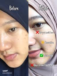 Rekomendasi Essence Terbaik untuk Cerahkan Kulit